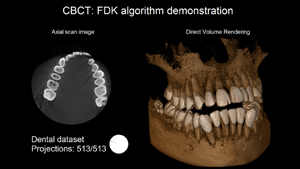 Dental dataset reconstruction. Axial scan & Volume Rendering.