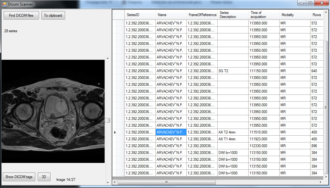 Dicom Scanner program interface